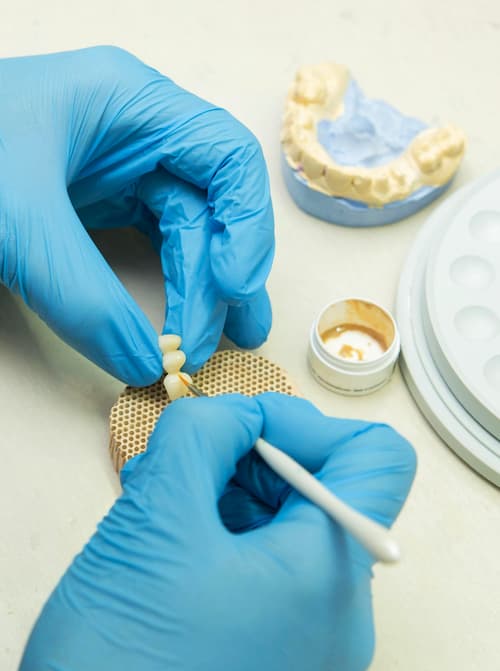 Technician shaping a crown