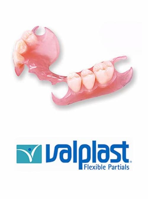 Valplast flexible partial